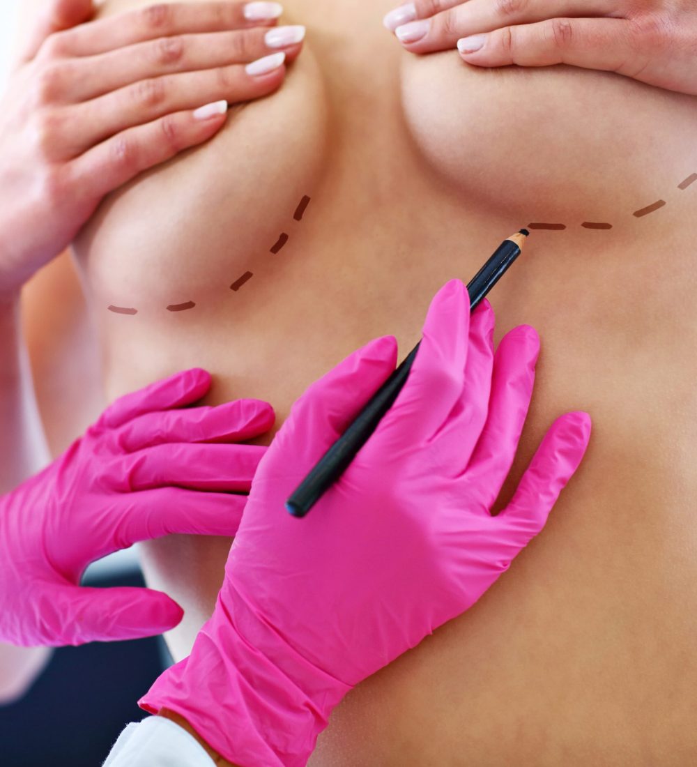 Brustchirurgie