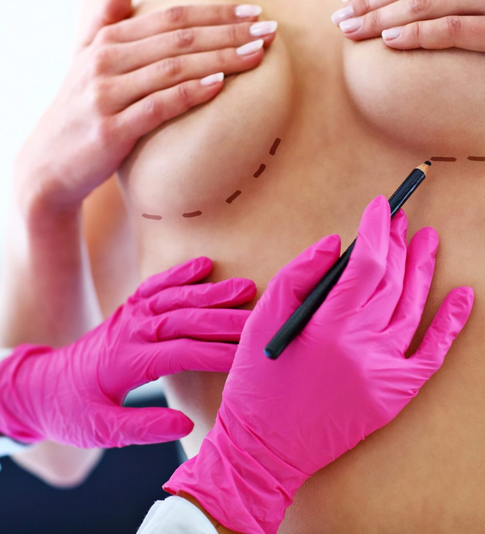 Brustchirurgie