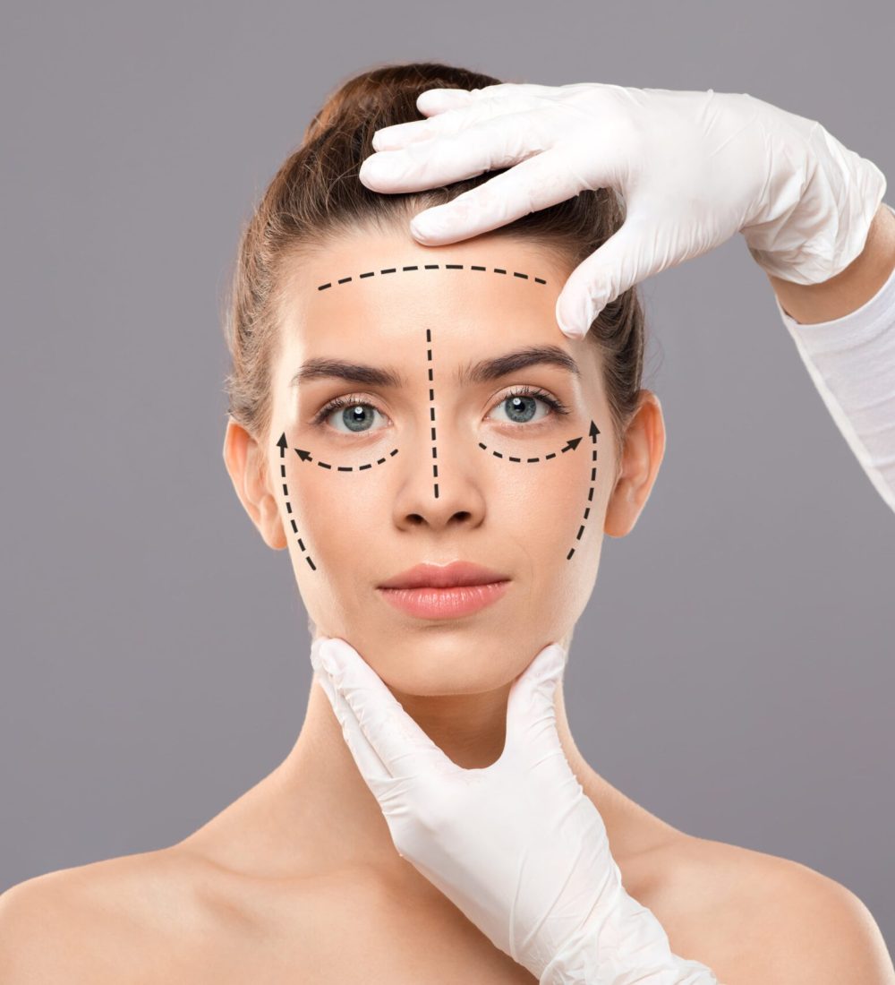 Facelifting